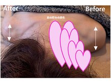 アッファシナンテ(Affascinante)/施術：オリジナル深筋骨メソッド