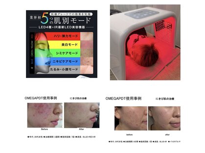 シュシュ(chou chou)の写真