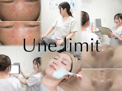 アンリミット 下北沢店(Une limit)の写真