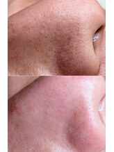 サロン サルタス(salon Saltus)/学生さんも◎学割メニュー