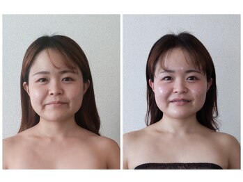 ぽかぽか/ラジオ波小顔