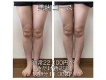 足楽ほんぽの雰囲気（O脚改善で細くなるだけでなくスラっときれいに魅せる足へ♪）