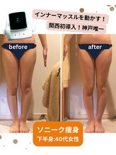 ボディデザインホームクレアフェリーチェ 神戸(Body design home Crea felice)/ソニーク痩身☆ビフォーアフター