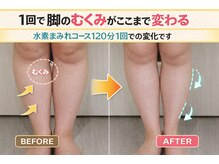 ヨサパーク ボヌール 門司駅店(YOSA PARK bonheur)/20代お悩みのむくみが一回で♪