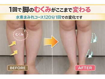 ヨサパーク ボヌール 門司駅店(YOSA PARK bonheur)/20代お悩みのむくみが一回で♪