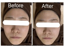 ラヴィエールフローラ(Laviere Flora)