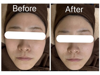 肌質改善 Laviere Flora【ラヴィエール フローラ】の写真