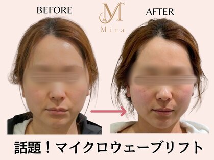 ミラ 札幌店(Mira)の写真