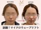 ミラ 札幌店(Mira)の写真