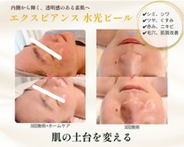 エテル(eter)