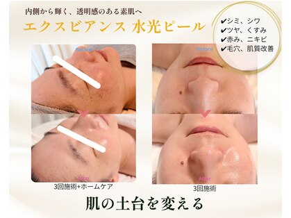 エテル(eter)の写真