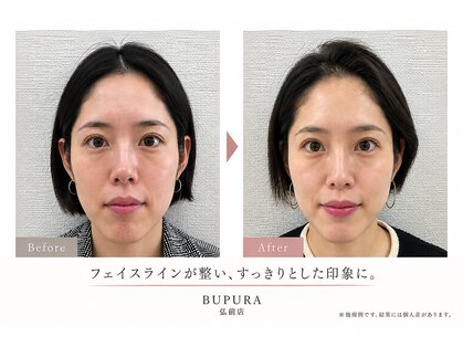 ブプラ 弘前店(BUPURA)の写真