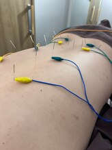 ハリマジック 代官山(HARI MAGIC)/【代官山/鍼灸/美容鍼】