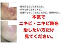 敏感肌の施術イメージ｜恵比寿keanax