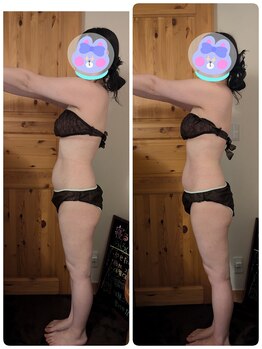 ヨサパーク アカーシャ(YOSA PARK AKASHA)/反り腰とお腹周りのお悩み