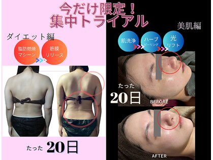 アダム(Adam)の写真