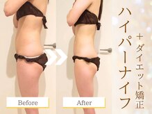 グレースフルの雰囲気（今年こそ5kg以上痩せたい方に♪【ダイエット/小顔/痩身/リンパ】）