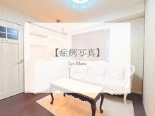リス ブラン(Lys Blanc)/lys blanc　before　after