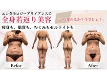 ビューティーマックス エースタジオ(Beauty MAX Astudio)