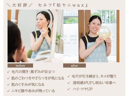オーノ(Ohno)の写真