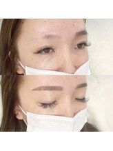 レッティー(retty)/地毛がなくても大丈夫！