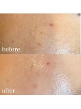 ソワイユ 浜松店(Soyeux)/ワックス脱毛（waw xxx）