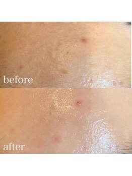 ソワイユ 浜松店(Soyeux)/ワックス脱毛(waw xxx)