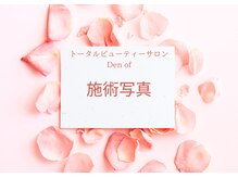 デンオブ(Den of)/【施術写真】[肩こり/腰痛/整体]