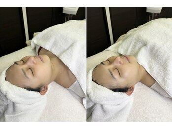 ミイン(miin)/ララピール＋ハイパーナイフ