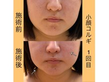オプレア 千種店(OPREA)の雰囲気（1回のコルギでフェイスラインがスッキリ！【小顔/痩身/美肌】）