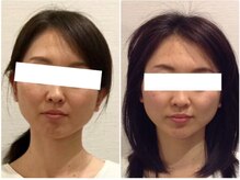 美容整体ウェリナ 名駅院/小顔矯正/骨盤矯正/美脚サロン