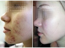 オリエンタルグリーン 銀座(ORIENTAL GREEN)/グリーンピール