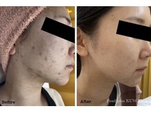 パールプラス 桑名店(Pearl plus)/before / after