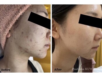 パールプラス 桑名店(Pearl plus)/before / after