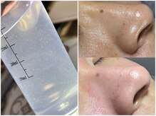 Lier&の雰囲気（ご紹介であれば男性も可。(※毛穴洗浄、温活他限定メニューのみ)）
