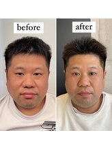 東京デトックス/首肩ストレッチ&ヘッドスパ