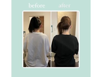 ハルノハナ鍼灸治療院/肩の盛り上がりもスッキリ
