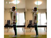 エヴォストレッチ(EVO STRETCH)/30代男性【姿勢改善】