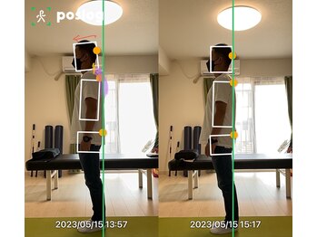 エヴォストレッチ(EVO STRETCH)/30代男性【姿勢改善】