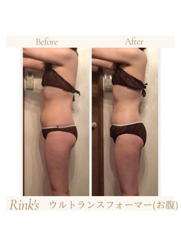 リンクス(Rink's)/before→after