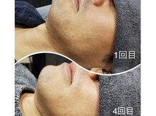アンドメイル(&male)