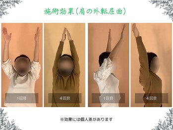 ボディ リセット アンド デザイン(Body Reset & Design)/【施術例】ビフォーアフター