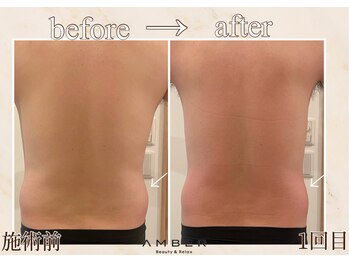 アンバー 恵比寿(AMBER)/運動では落ちにくい腰周りにも