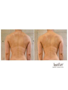 サプナジー(Suppnrgy)/カスタムトリートメント