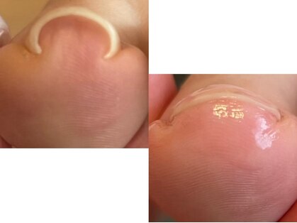 エマネイル(emma nail)の写真