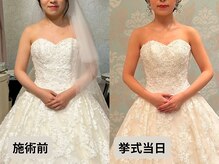 優子さんの美容矯正サロンの雰囲気（天使の羽クッキリ!背中のもたつき肉撃退!（池袋ブライダル痩身））