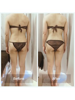 リアン(Lien)/全身オイルリンパデトックス