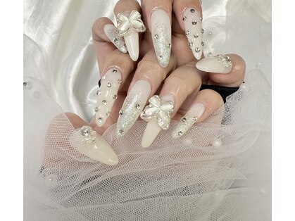 チュンチュン(Chunchun)の写真
