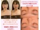 パピヨン(papillon)の写真