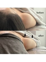 ベール(BEHL)/コルギのBefore After